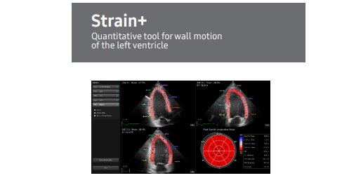 Guide on Using Speckle Tracking Echocardiography with Strain+ for Left Ventricular Analysis