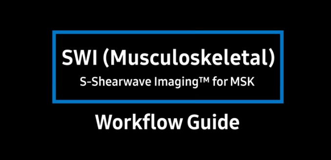 Workflow Guide on MSK Ultrasound with S-Shearwave Imaging using RS85 ultrasound machine