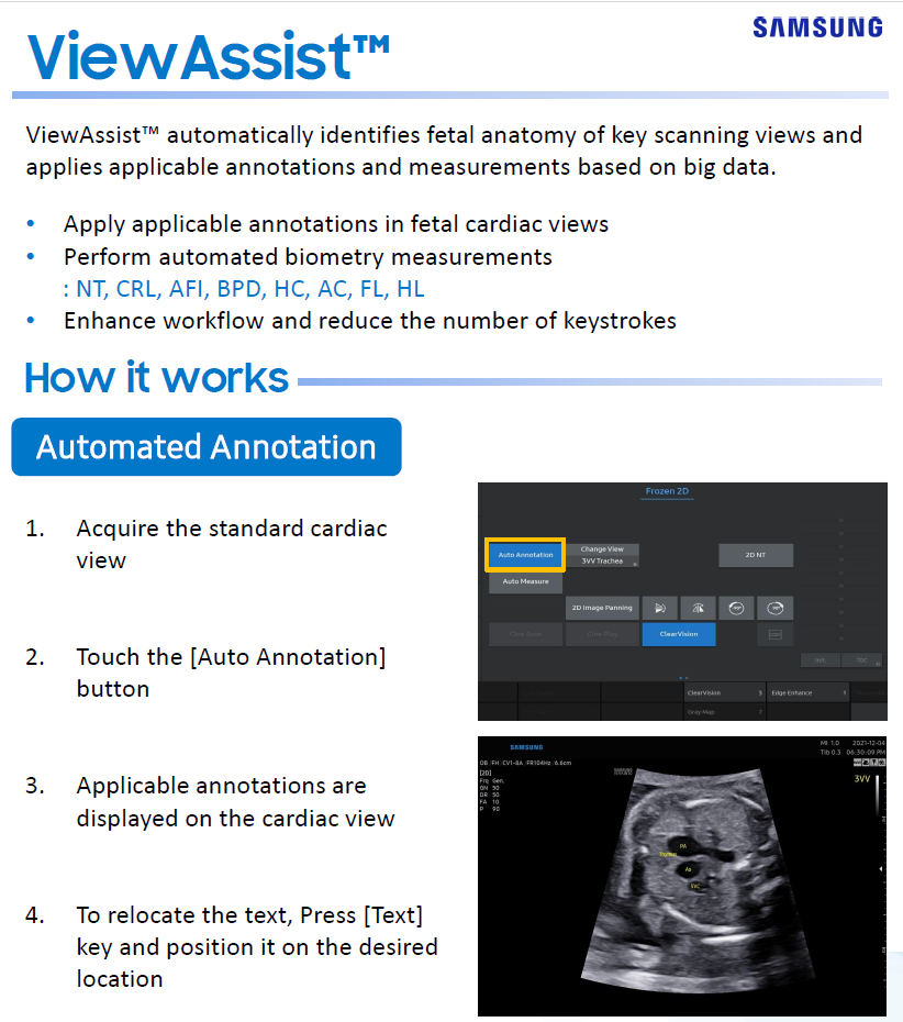 Quick overview of ViewAssist™ for fetal ultrasound automation on the HERA W10 Elite