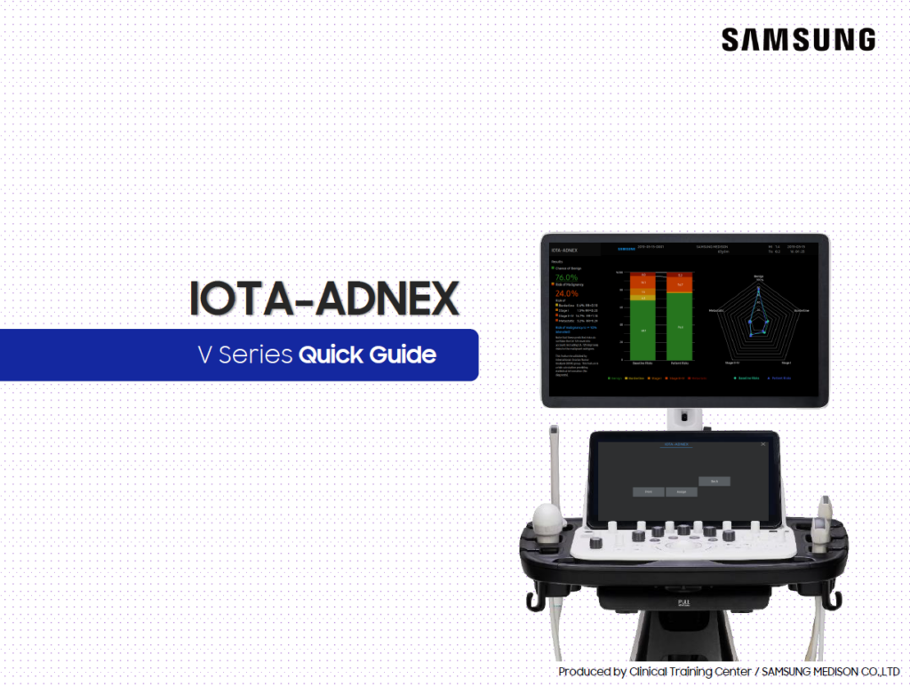 Quick guide on IOTA-ADNEX for adnexal mass and ovarian cancer risk assessment on the Samsung V8, V7, and V6 ultrasound systems