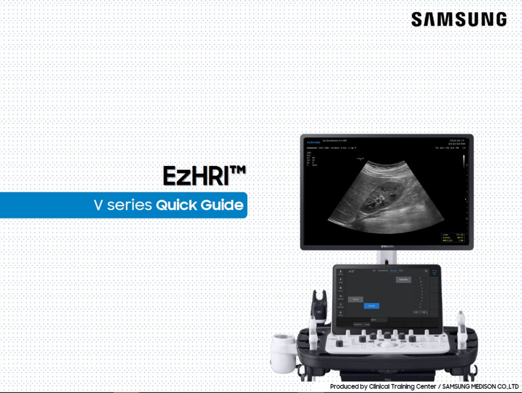 Quick guide on using EzHRI™ for hepato renal index measurement on the V8, V7, V6 ultrasound systems