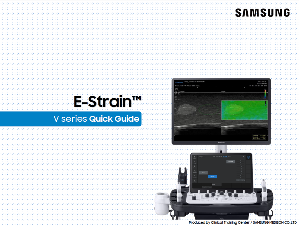 Quick guide on using E-Strain™ for breast elastography and strain ratio measurement on the V8, V7, V6 ultrasound machines