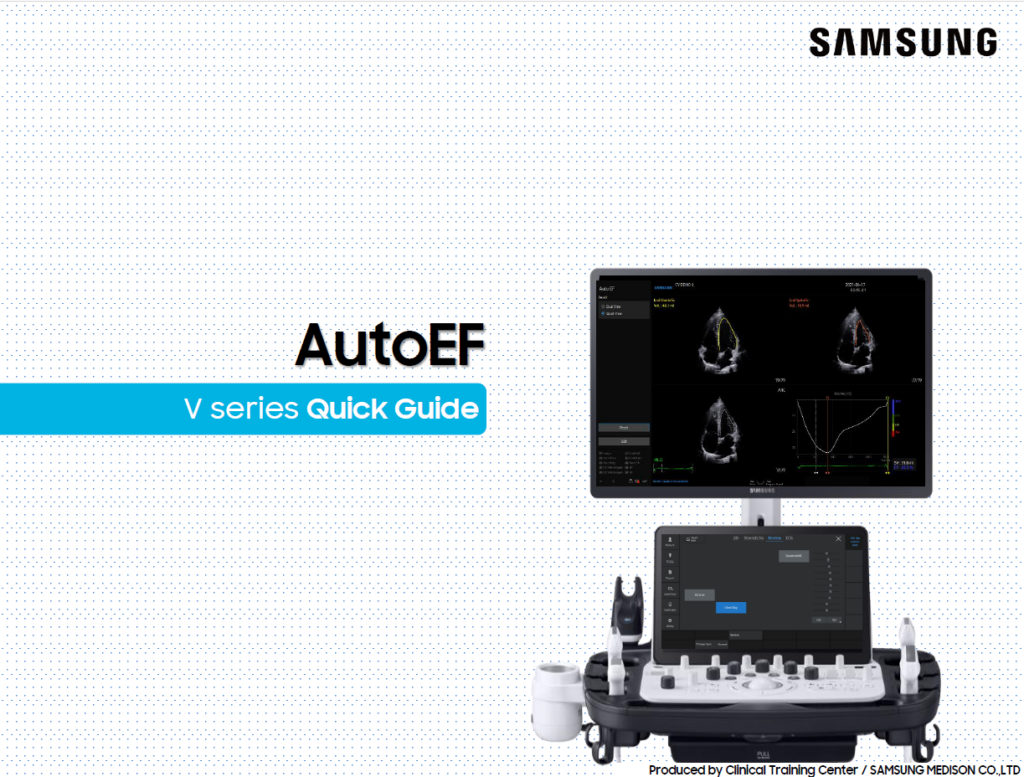 Quick guide on AutoEF for automatic ejection fraction measurement during cardiac ultrasound on V8, V7, and V6 ultrasound machines