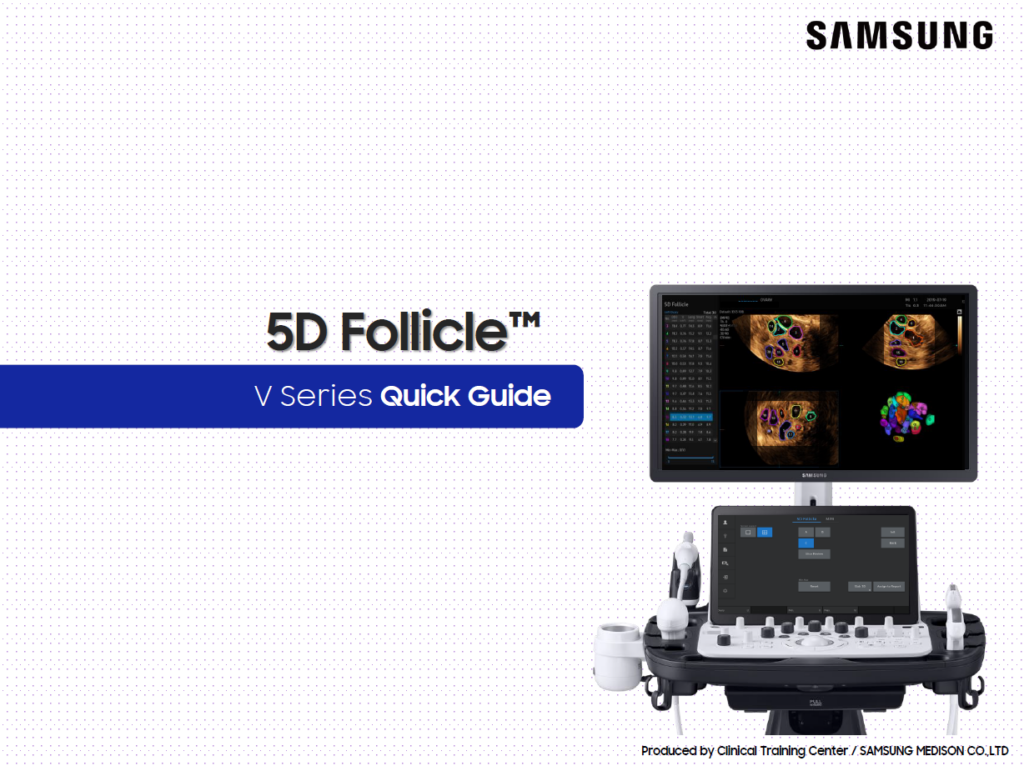 Quick guide on 5D Follicle™ for ovary ultrasound and 3D follicle measurement on the Samsung V8, V7, and V6 ultrasound systems