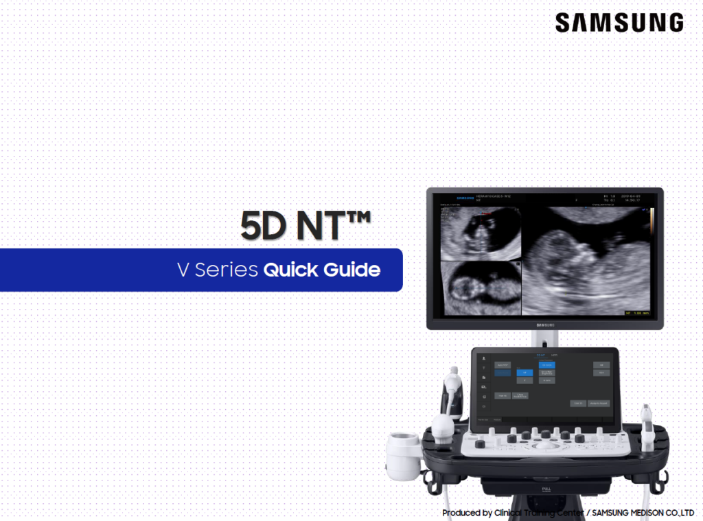 Quick guide on 5D NT™ for nuchal translucency measurement using fetal ultrasound on the Samsung V8, V7, and V6 ultrasound machines
