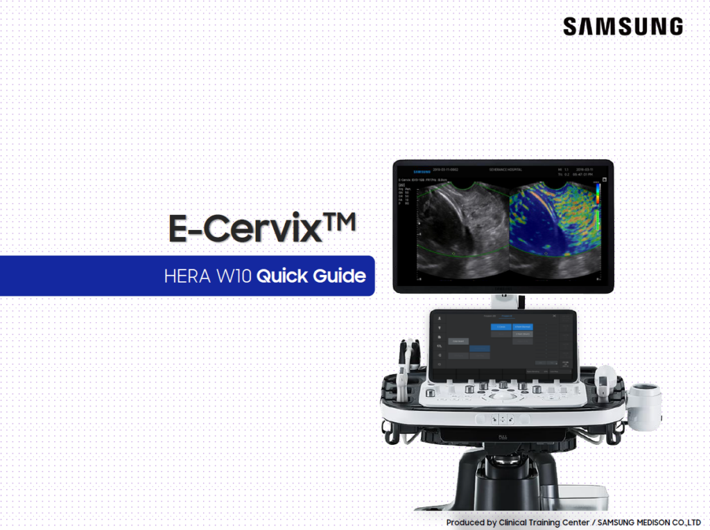 Quick Guide on how to use E-Cervix™ for cervical elastography on the HERA W10