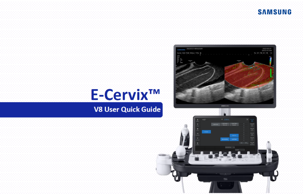 Quick guide on E-Cervix™ cervical elastography with V8 ultrasound for assessing cervix stiffness and preterm birth prediction