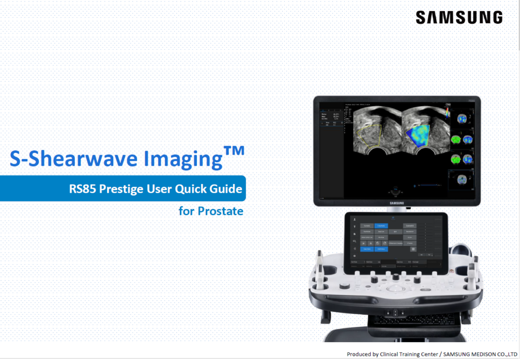 Quick guide on using S-Shearwave Imaging™ for prostate stiffness measurement with RS85 Prestige ultrasound