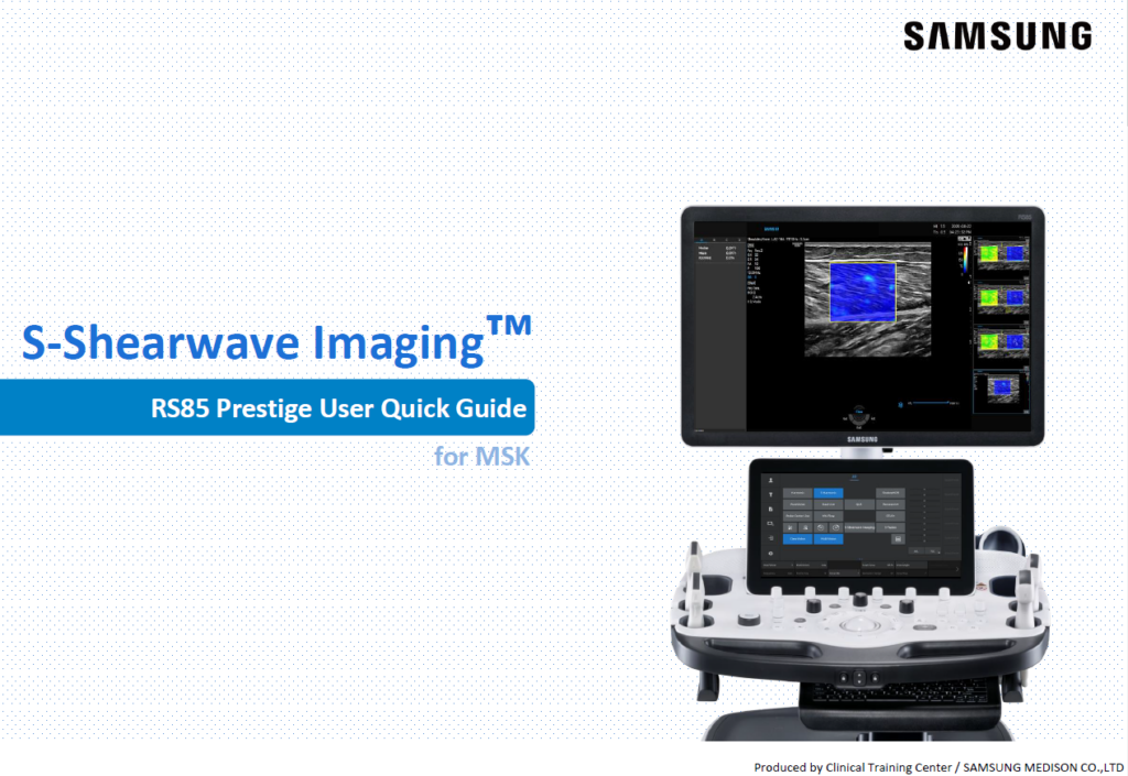 Quick guide on using S-Shearwave Imaging™ for musculoskeletal ultrasound and elasticity measurement on the RS85 Prestige system