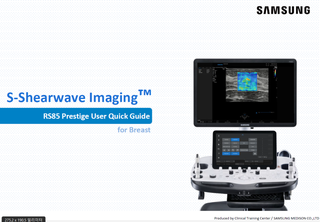 Quick guide on S-Shearwave Imaging™ for breast ultrasound using RS85 Prestige and shear wave elastography