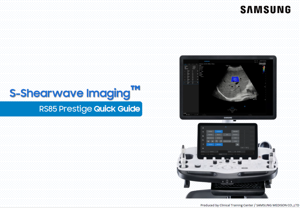 Quick guide on S-Shearwave Imaging™ for liver stiffness assessment using RS85 Prestige ultrasound machine