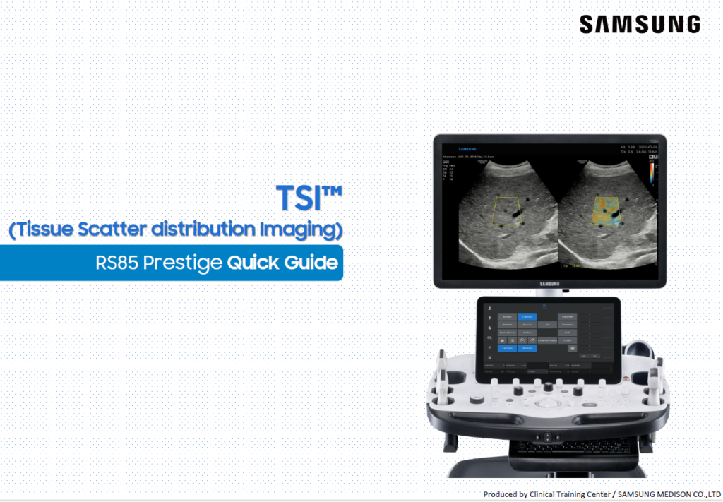 Quick guide on using TSI™ for quantitative liver ultrasound and tissue scatter imaging on the RS85 Prestige system