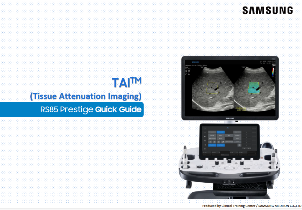 Quick guide on using TAI™ for quantitative liver ultrasound and tissue attenuation imaging on the RS85 Prestige system