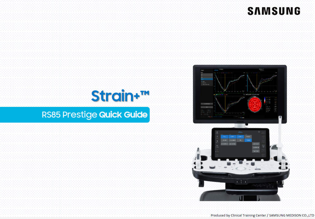 Quick guide on using Strain+™ for cardiac ultrasound and LV strain analysis with RS85 Prestige