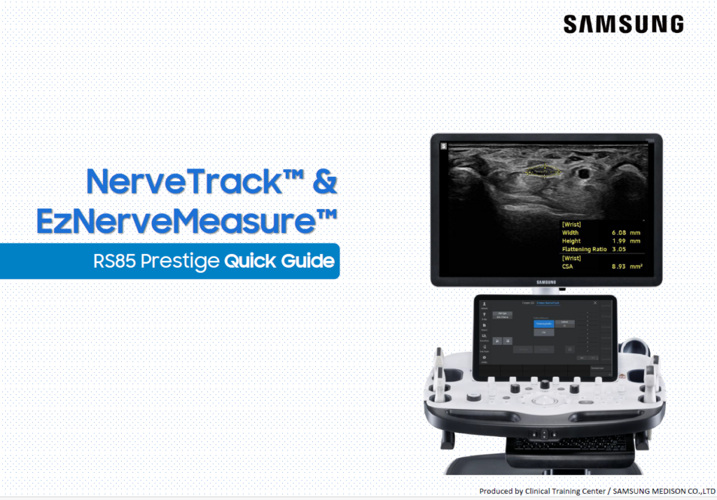 Quick guide on using NerveTrack™ and EzNerveMeasure™ for nerve tracing and CSA measurement on the RS85 Prestige system