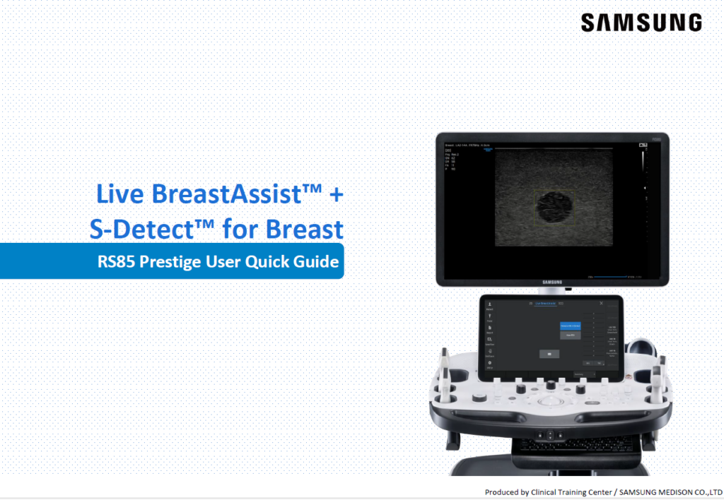 Quick Guide on Live BreastAssist™ and S-Detect™ for breast lesion detection and BI-RADS classification in breast ultrasound
