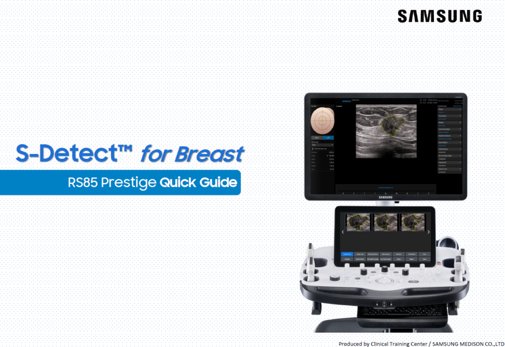 Quick guide on using S-Detect™ for Breast in ultrasound with BI-RADS classification on the RS85 Prestige system