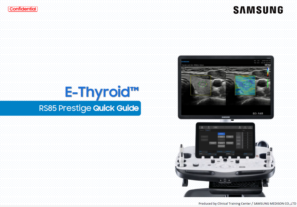 Quick guide on using E-Thyroid™ for thyroid elastography and ECI-based nodule evaluation on the RS85 Prestige ultrasound machine