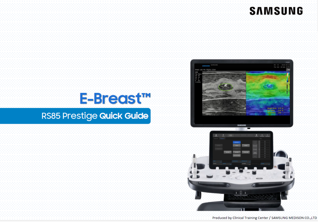 Quick guide on using E-Breast™ for breast elastography and strain ratio imaging on the RS85 Prestige system