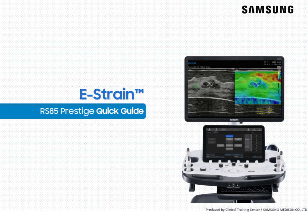Quick guide on using E-Strain™ for breast elastography and strain ratio imaging on the RS85 Prestige system
