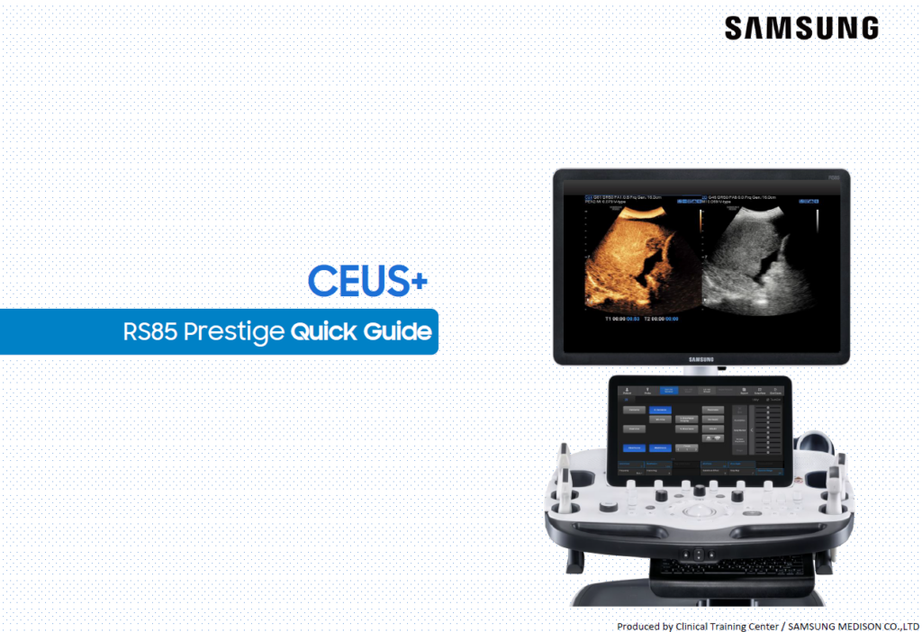 Quick guide on using CEUS+ for contrast-enhanced ultrasound and TIC analysis on the RS85 Prestige ultrasound system