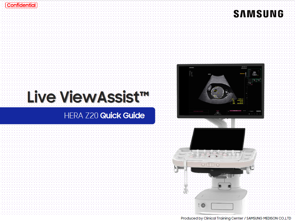 Quick Guide on Live ViewAssist™ for Real-Time Ultrasound Guidance on HERA Z20