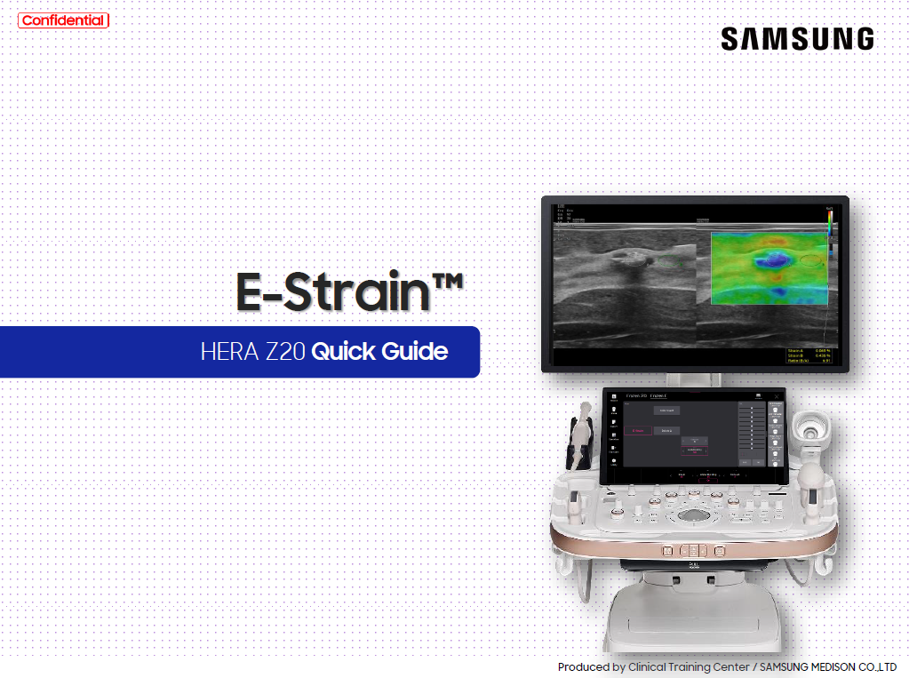 Quick Guide on E-Strain™ for breast ultrasound using strain elastography with HERA Z20