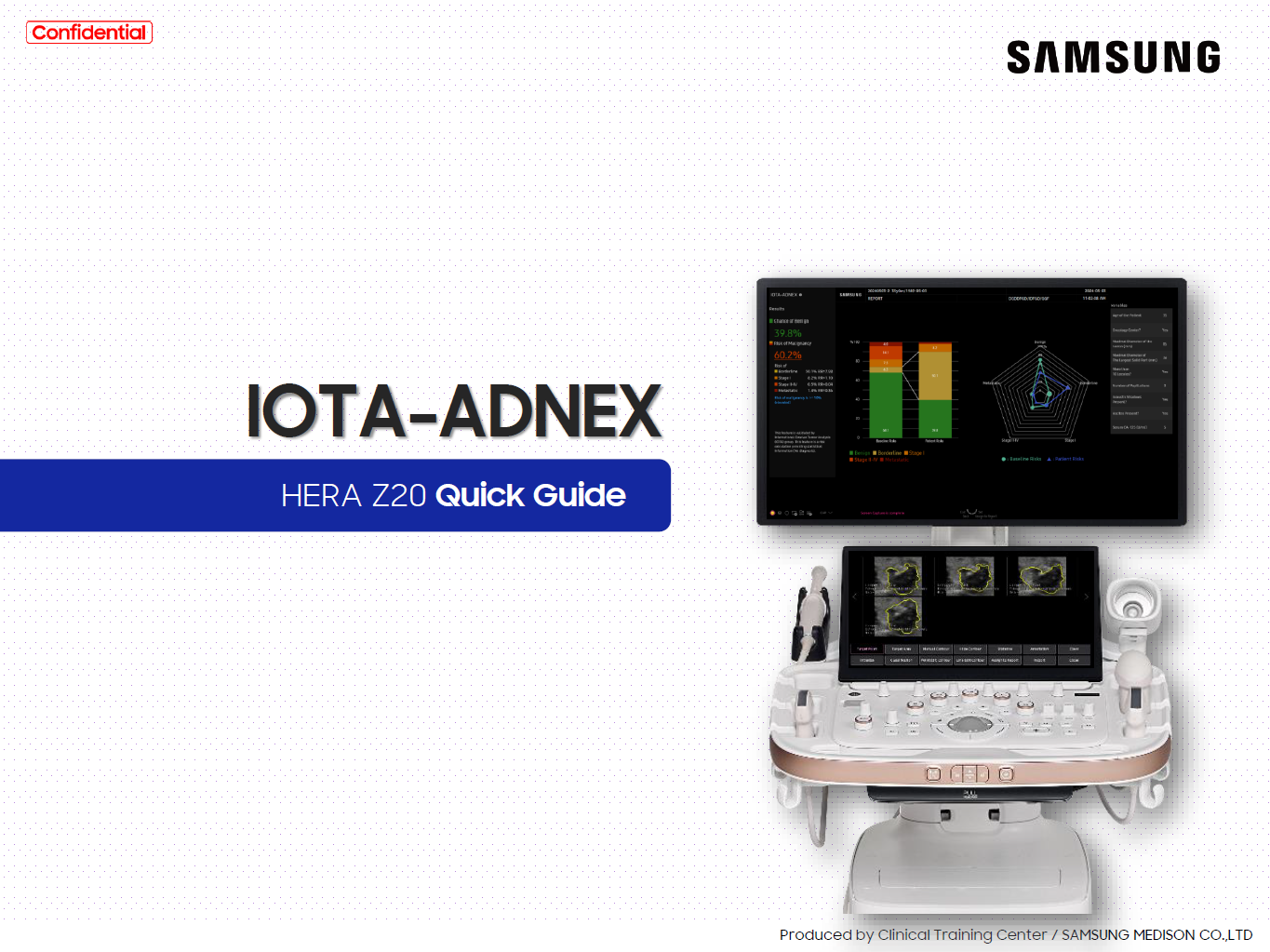 Quick Guide on IOTA-ADNEX for adnexal mass and ovarian tumor risk assessment using HERA Z20