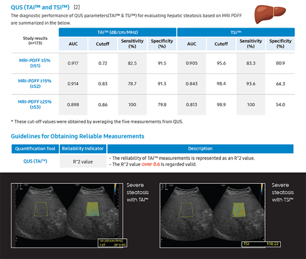 Technical leaflet on V Series ultrasound QUS tools for liver steatosis & fibrosis assessment