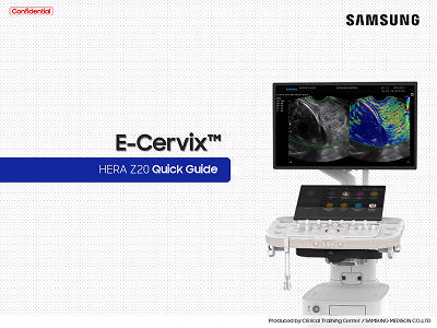 Quick Guide on using E-Cervix™ with ElastoScan+ for cervical stiffness evaluation on HERA Z20 ultrasound
