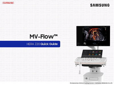 Quick Guide on MV-Flow™ for microvascular imaging with ROI, parameters, and vascularity index on HERA Z20