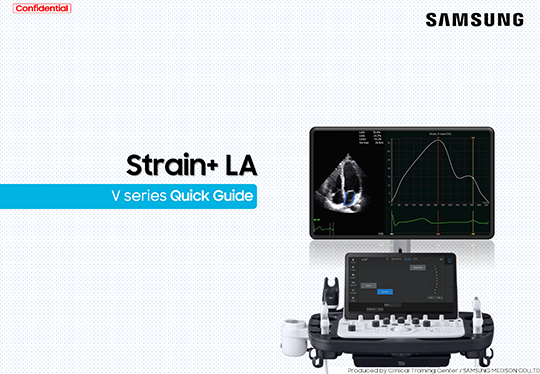 Quick Guide on Strain+ LA for left atrial strain assessment with V Series ultrasound