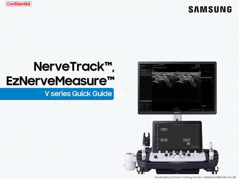 Quick Guide on NerveTrack™ with EzNerveMeasure™ for nerve tracking and measurement on V Series ultrasound