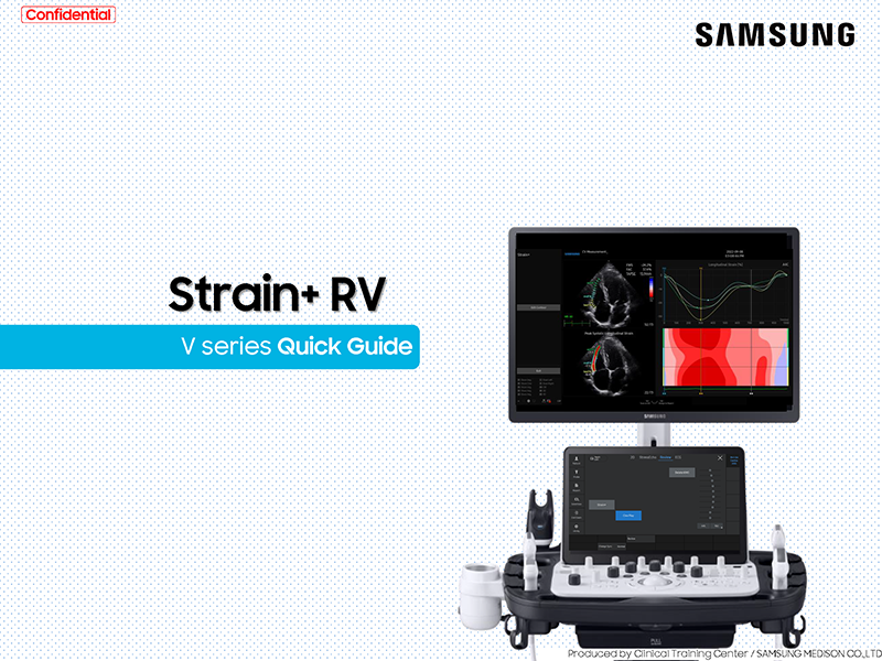 Quick Guide on Strain+ RV for right ventricular strain assessment with V Series ultrasound