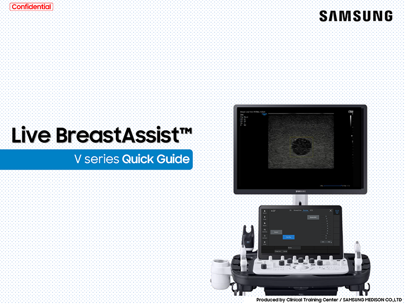 Quick Guide on Live BreastAssist™ for breast ultrasound and lesion detection with V Series ultrasound