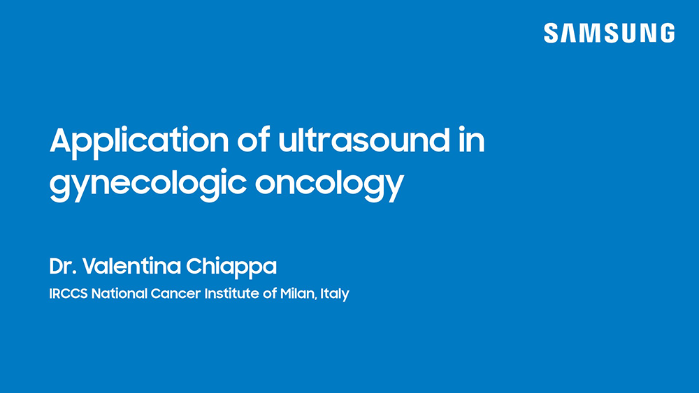 Webinar on gynecologic oncology ultrasound covering ovarian, endometrial, and cervical cancer imaging