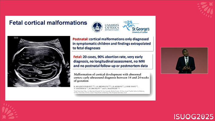 ISUOG 2025 satellite symposium on fetal echocardiography and prenatal cardiac assessment