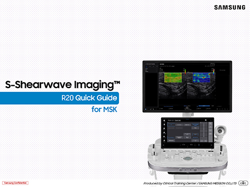 Quick guide on S-Shearwave Imaging™ for musculoskeletal ultrasound on the R20 ultrasound machine.
