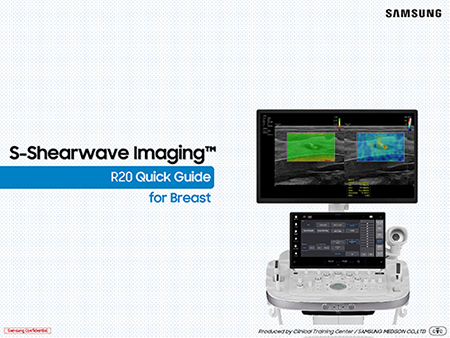 Quick guide on S-Shearwave Imaging™ for breast ultrasound on the R20 ultrasound system
