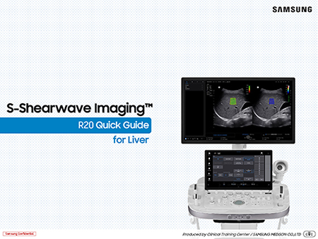 Quick guide on S-Shearwave Imaging™ for liver stiffness evaluation on the R20 ultrasound system