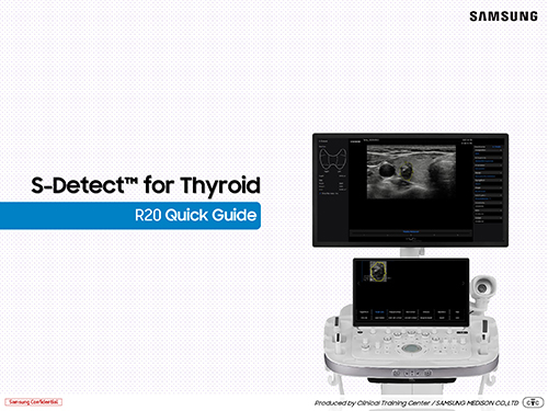 Quick guide on S-Detect™ for thyroid ultrasound on the R20 ultrasound system