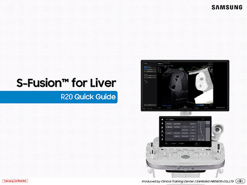 Quick guide on S-Fusion™ for liver ultrasound with CT and MRI image fusion on the R20 ultrasound system