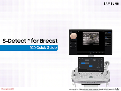 Quick guide on S-Detect™ for breast ultrasound on the R20 ultrasound system