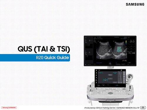 Quick guide on QUS using TAI and TSI for liver tissue attenuation and scatter measurement on the Samsung R20 ultrasound system