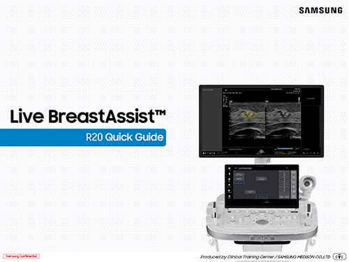 Quick guide on Live BreastAssist™ for real-time breast ultrasound with lesion indication and ROI visualization on the R20 ultrasound system