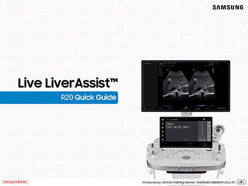 Quick guide on Live LiverAssist™ for real-time liver ultrasound with lesion indication and ROI visualization on the R20 ultrasound system
