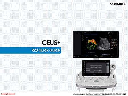 Quick guide on CEUS+ for contrast enhanced ultrasound imaging and time intensity curve analysis on the R20 ultrasound system