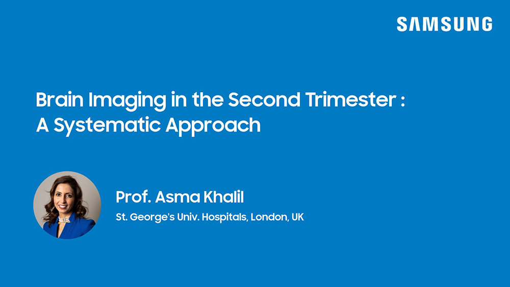 Webinar on fetal brain ultrasound systematic second trimester assessment