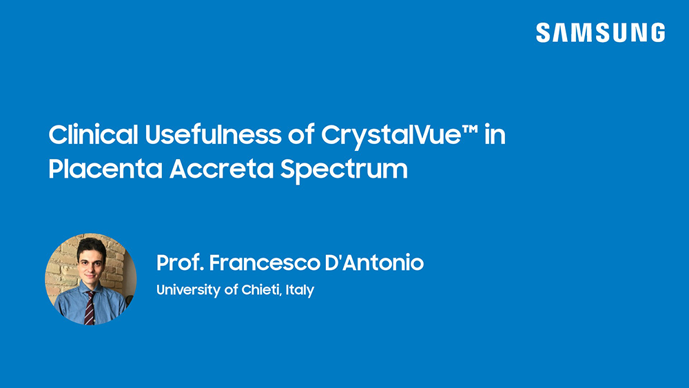 Webinar presentation on placenta accreta spectrum ultrasound