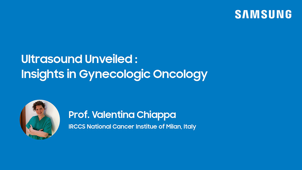 Ultrasound unveiled : Insights in gynecologic oncology